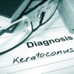 Treatment options for keratoconus