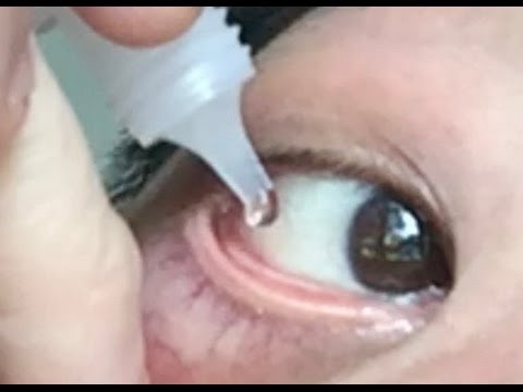 How to use eye drops properly