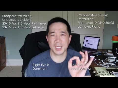 2 weeks after symfony lens. First-hand experience from ophthalmologist - Shannon Wong, MD.