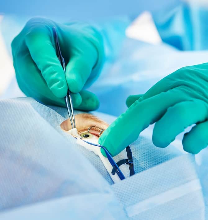 Corneal Transplant Surgery in Austin