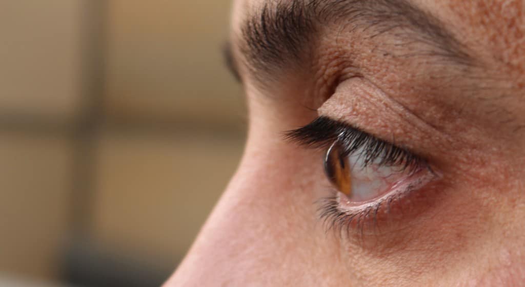 Corneal Crosslinking in Austin, TX