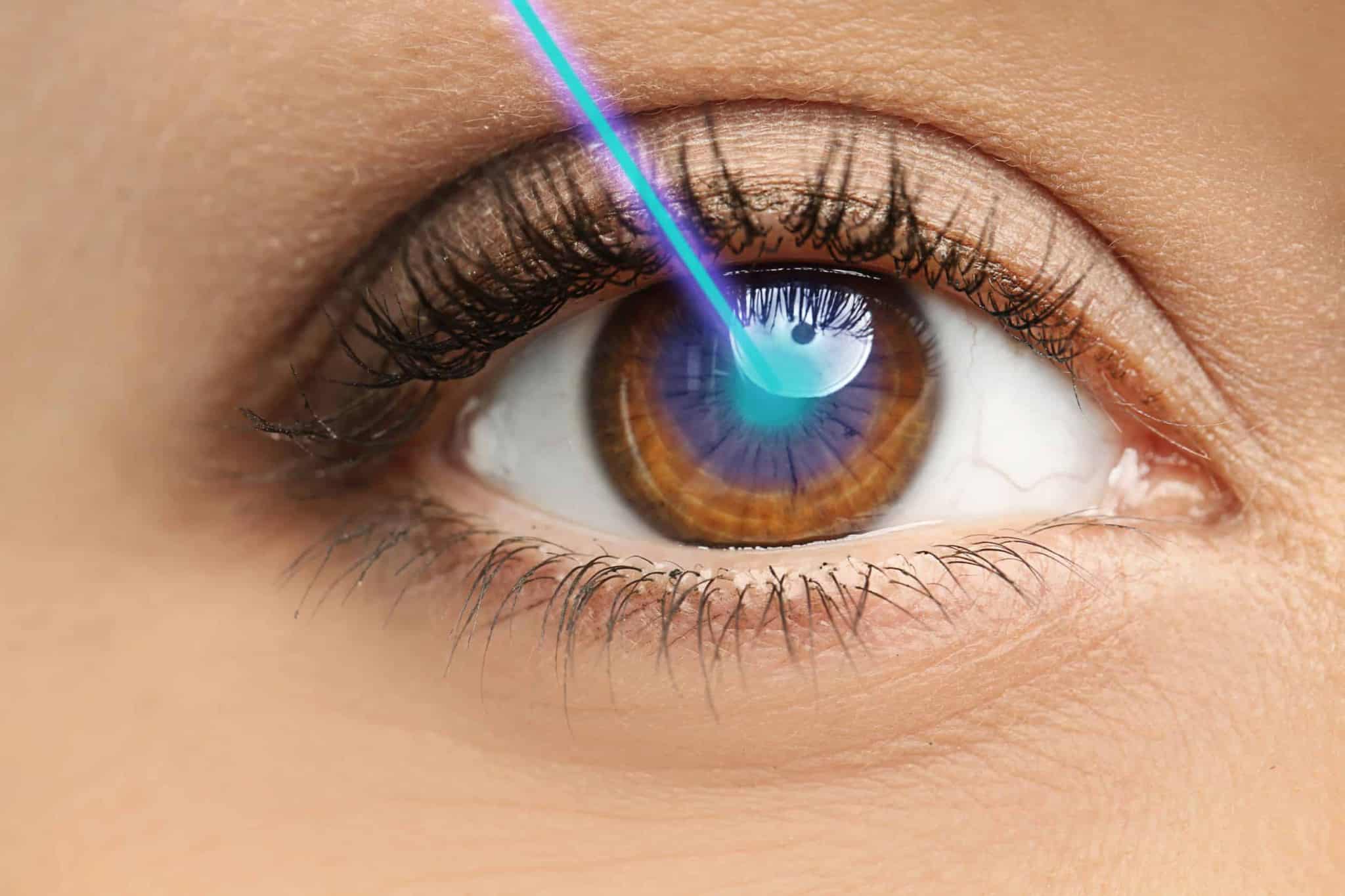 LASIK Surgery in Austin, TX