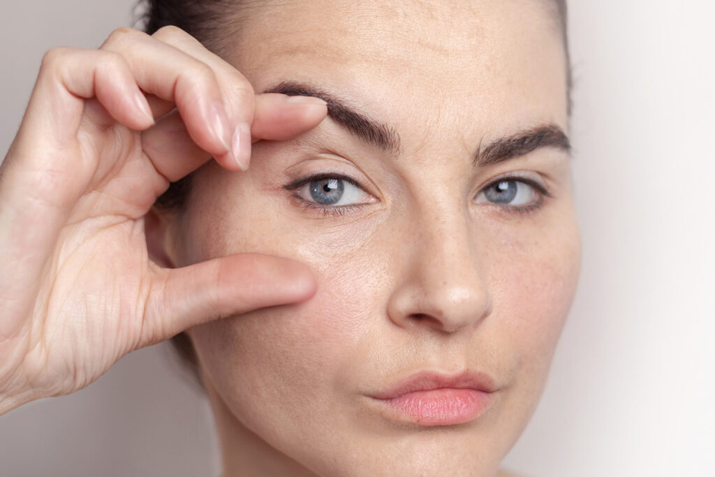 Woman holding her eyes open before upper blepharoplasty for hooded eyes